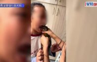 唔搵牙醫靠鸚鵡剝牙片瘋傳 醫生警告: 隨時染禽流感