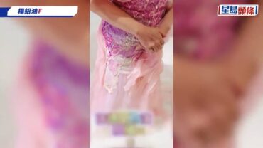 66歲張德蘭紅館開騷前驚傳意外!試衫不慎跌倒左膊骨裂兼甩骹 留院將要接受小手術